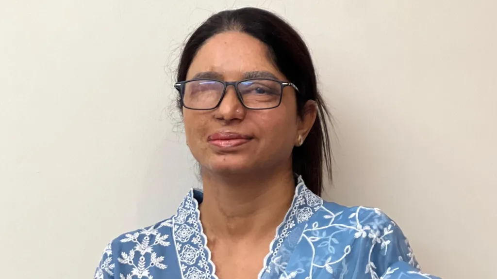 A woman is wearing a blue and white dress. The left part of her face has scars and looks disfigured due to an acid attack.
