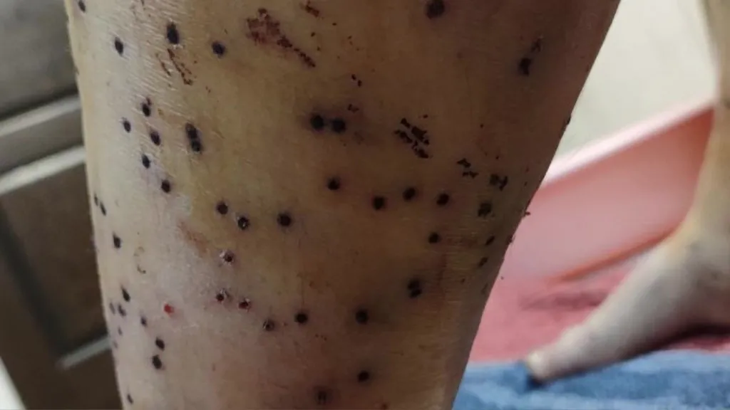 Birdshot wounds on the leg of a protester in Iran