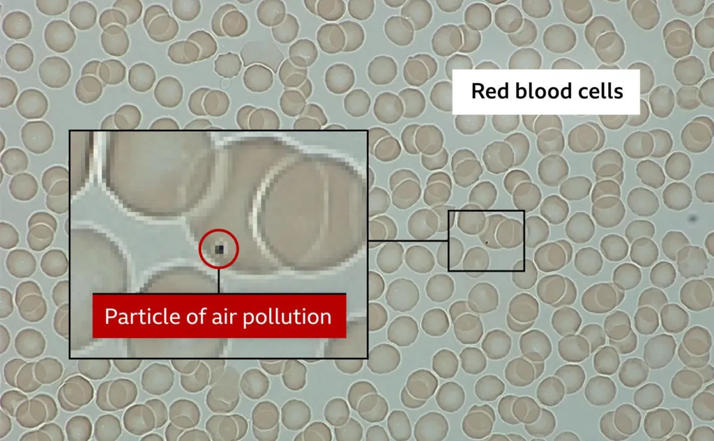 Dozens of red discs fill the picture and are labelled "red blood cells". There is a zoom in box which shows a grainy close up of five red blood cells. One of them has a black smudge on it which is labelled "particle of air pollution".  