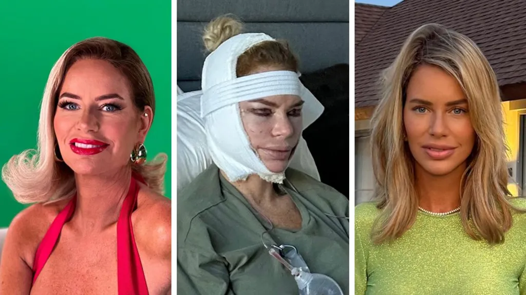Composite of Caroline Stanbury pre and post face lift surgery. In the first picture she is looking at the camera with her blonde hair styled to be swept over her right side. She is wearing a red top and has large gold earrings on and red lipstick. The middle picture shows her with bandages wrapped around her head and wearing what appears to be a hospital gown. In the third picture she has long blonde hairs and is wearing a light green top with a pearl necklace.